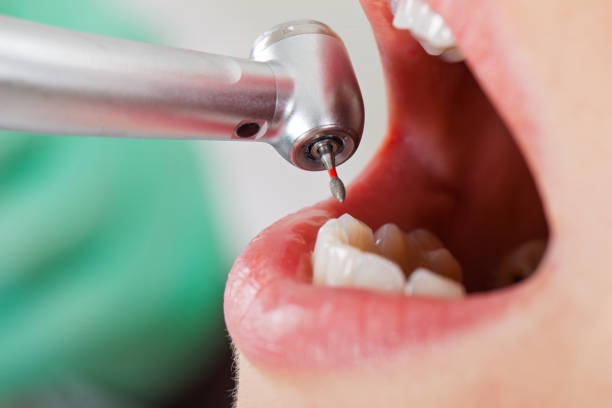 Reliable TX Emergency Dentist Solutions